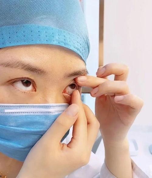 带隐形眼镜的视频,跟随视频揭秘带镜生活
