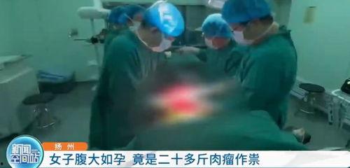 腹部检查视频,直观解析人体腹部健康秘密