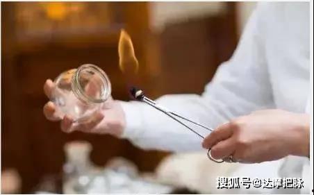 拔罐操作视频教程,视频教程详解